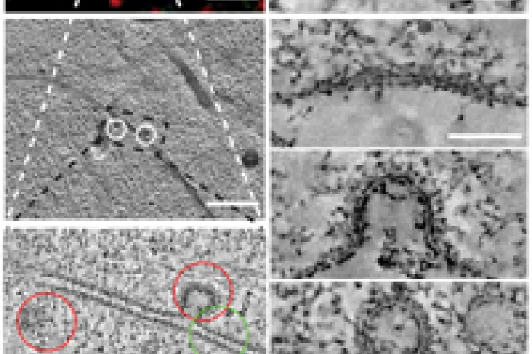 Electron Microscopy Core Facility